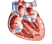 "심방 구조·기능 이상, 치매 위험↑"