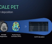 뉴로핏, PET 영상 자동분석소프트웨어 '뉴로핏 스케일 펫' 美 FDA 허가 획득