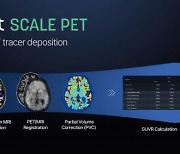 뉴로핏 "PET 영상 자동분석 소프트웨어, FDA 허가"