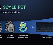 뉴로핏, PET 영상 자동 분석 소프트웨어 '뉴로핏 스케일 펫' 美 FDA 허가 획득