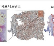 서울대 권성훈 교수 연구팀, AI 차세대 암 진단 지표 개발