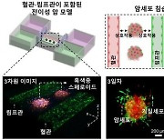 3D 바이오프린팅으로 인공 암조직을 만들었다