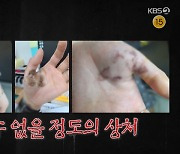 공격성 강한 문제견 심각한 입질, 보호자 친구 "인대 파열, 신경 손상"(개훌륭)