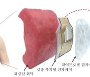 '돌연사 주범' 부정맥 실시간 진단·치료 전자 패치 개발