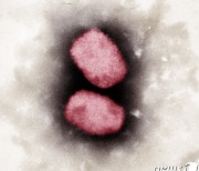 中 본토서 첫 원숭이두창 확진 발생..코로나 격리 중 증상 나타나