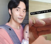 윤주만, 수족구병 후유증 이렇게 심할 줄이야..다 벗겨진 손 '충격'