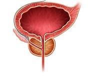 [건강in] 전립선비대증 악화하면 암으로 변할까?