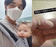 윤주만, 딸과 함께 걸린 이 병..무서운 후유증 "다 벗겨짐"