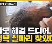 [자막뉴스] 탈모 정복 실마리 찾았다..국내 연구진이 개발한 신기술