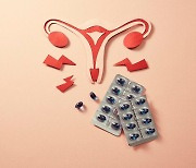 생리통에는 아세트아미노펜보다 이부프로펜?..'생리통약', 많이 묻는 질문 7가지