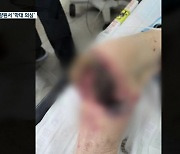 "아버지 무릎 썩는데 공립 요양원서 방치"..경찰 수사