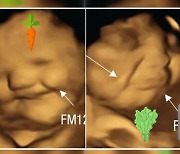 [지구촌 더뉴스] "태아도 음식 선호도 있다..당근엔 미소, 케일엔 울상"