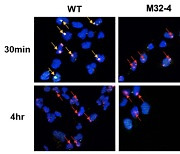 IBS, DNA 손상 복구하는 핵심 단백질 작용 규명