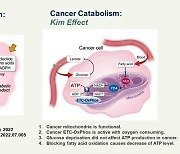 암이 지방을 먹고 큰다?..김수열 박사팀 세계 최초 규명