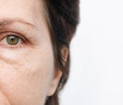 눈밑지방재배치술과 하안검수술의 차이는?