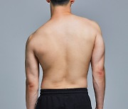 [건강톡톡] "틀어지고 휜 허리"..청소년기 척추측만증의 치료·관리법