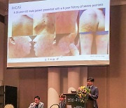 미라셀, 방콕 세계미용성형학회서 줄기세포 난치성피부 치료 성과 발표