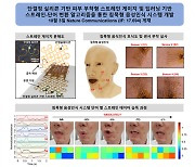 농아인 소통 장벽 없앤다..말할 때 얼굴 피부 변화 감지해 단어 인식