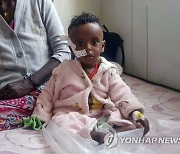 Ethiopia Tigray Mother and Child Deaths