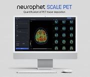 뉴로핏, 시범사업 통해 AI 뇌영상분석 소프트웨어 병원 공급