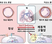 '폐동맥 고혈압' 위험 높이는 유전자 경로 찾았다