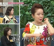 女배우 팔에 화상 자국이? “살림 4년차, 주부 우울증 걸려” 이효춘의 고백