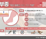 신발 작아지고 반지 꽉 낀다면? ... 부종의심해봐야