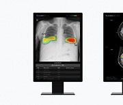 루닛, '세계 최대 규모' 영상의학회에서 연구초록 11편 발표