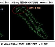 길로 연구소·메드팩토 "세계 최초로 위암세포 간 전이 기전 발견"