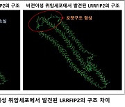 메드팩토·길로연구소, 세계 최초 '위암세포 간 전이' 기전 발견