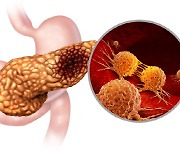췌장암의 ‘뚜렷한 전조 증상’… 알아두면 3년 일찍 발견할 수도