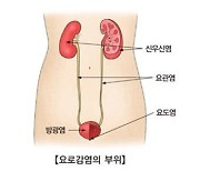 "새 복합 항균제제, 저항성 요로 감염에 특효"