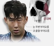 [그래픽] 손흥민 눈 주위 골절수술