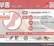 [콕!건강]작아진 신발, 꽉 끼는 반지…부종치료 원인부터 찾아야