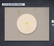 [단독] 환경과학원 “대구MBC 보도 현미경 촬영본, 수돗물 남세균 가능성 희박”