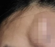 더치페이 거부해 폭행한 소개팅男, 그 다음날 “결혼정보업체에 비밀로”