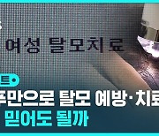 [D리포트] "탈모 예방 · 치료 샴푸는 없어요"