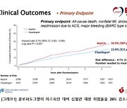 관동맥스텐트 환자, 아스피린보다 플라빅스 복용 ‘유리’