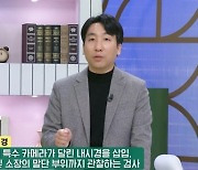 한윤대 교수 밝힌 대장 내시경 꼭 해야 하는 이유(아침마당)