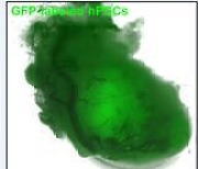 줄기세포 이용한 ‘미니 심장’ 국내 최초로 개발