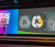 지엔티파마, 뇌졸중 신약 임상3상 등록 환자 50% 넘겨