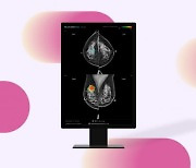 루닛 "호주 국영 유방암 검진 프로그램 운영권 단독 수주"