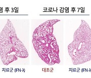 서울대병원 연구팀, '코로나 증상 완화' 흡입형치료제 개발한다