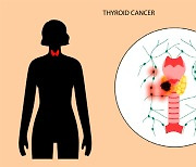갑상선암 환자, 수술 전부터 수면의 질 크게 떨어져