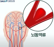 머릿속 시한폭탄 ‘뇌동맥류’ 증상과 치료법은 무엇?