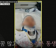 버스 앞 칼치기에 여고생 '사지마비'···"사과 한 번 없었다"