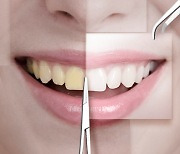 “정말 하얘질 수 있을까?”…‘치아미백’ 종류별 효과 및 주의사항