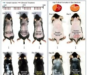 "케라틴 발모 효능 밝혀내…탈모치료제 가능성 기대"