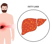약 없는 '지방간', B형간염 치료제 썼더니 개선