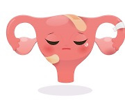 국내 자궁근종 환자, 5년새 60% 급증…40대 이하 증가세